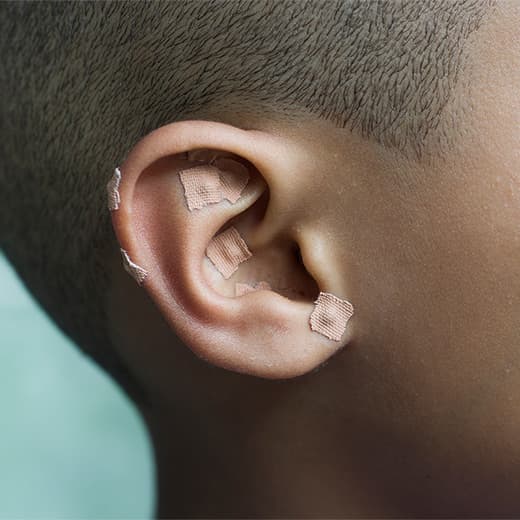 Image of Ear Seeding