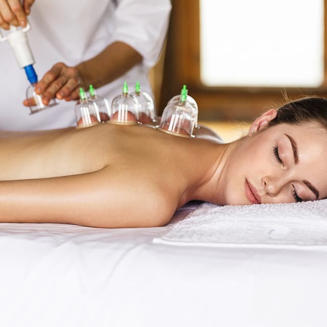Image of Cupping Therapy