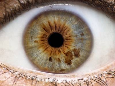 Iridology: It's All in the Eyes
