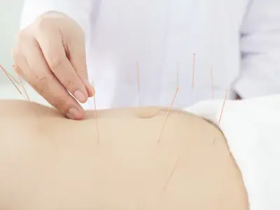 Acupuncture for Weight Loss