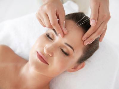 Acupuncture for Migraines & Headaches