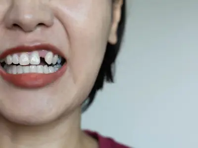 What Does it Mean When You Dream About Teeth Falling Out?