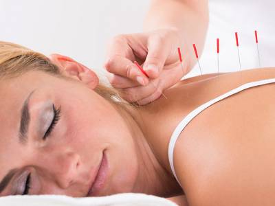 Acupuncture: Let’s Get to the Point