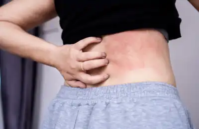 Treating itchy skin with tea tree oil