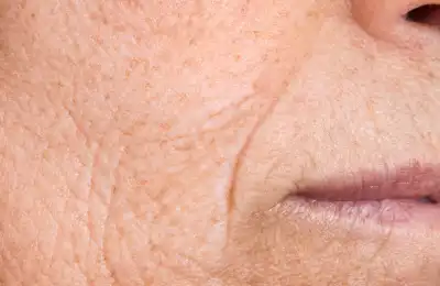 Is Frankincense Oil Good for the Skin?