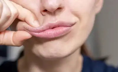The Lip Plumper face yoga