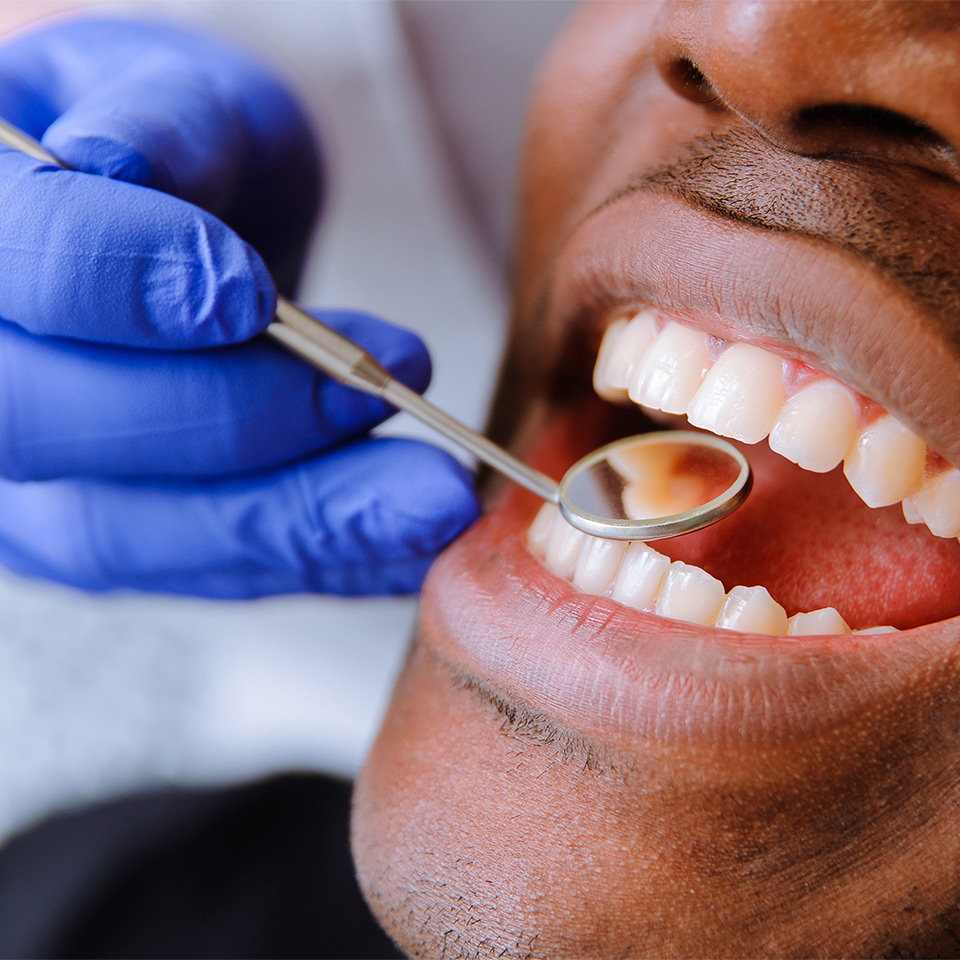 Dentist holding a dental instrument in a man’s mouth as part of a check up