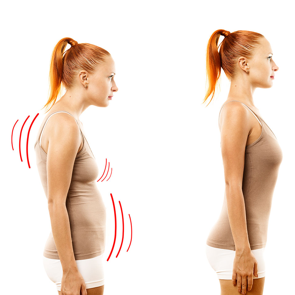 Woman with poor and improved posture.