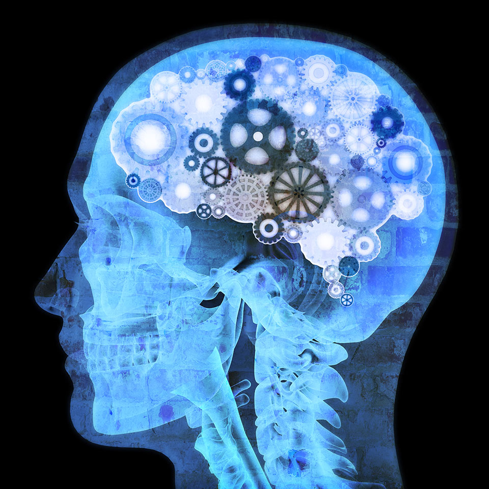 X-Ray of a man's head with gears for a brain