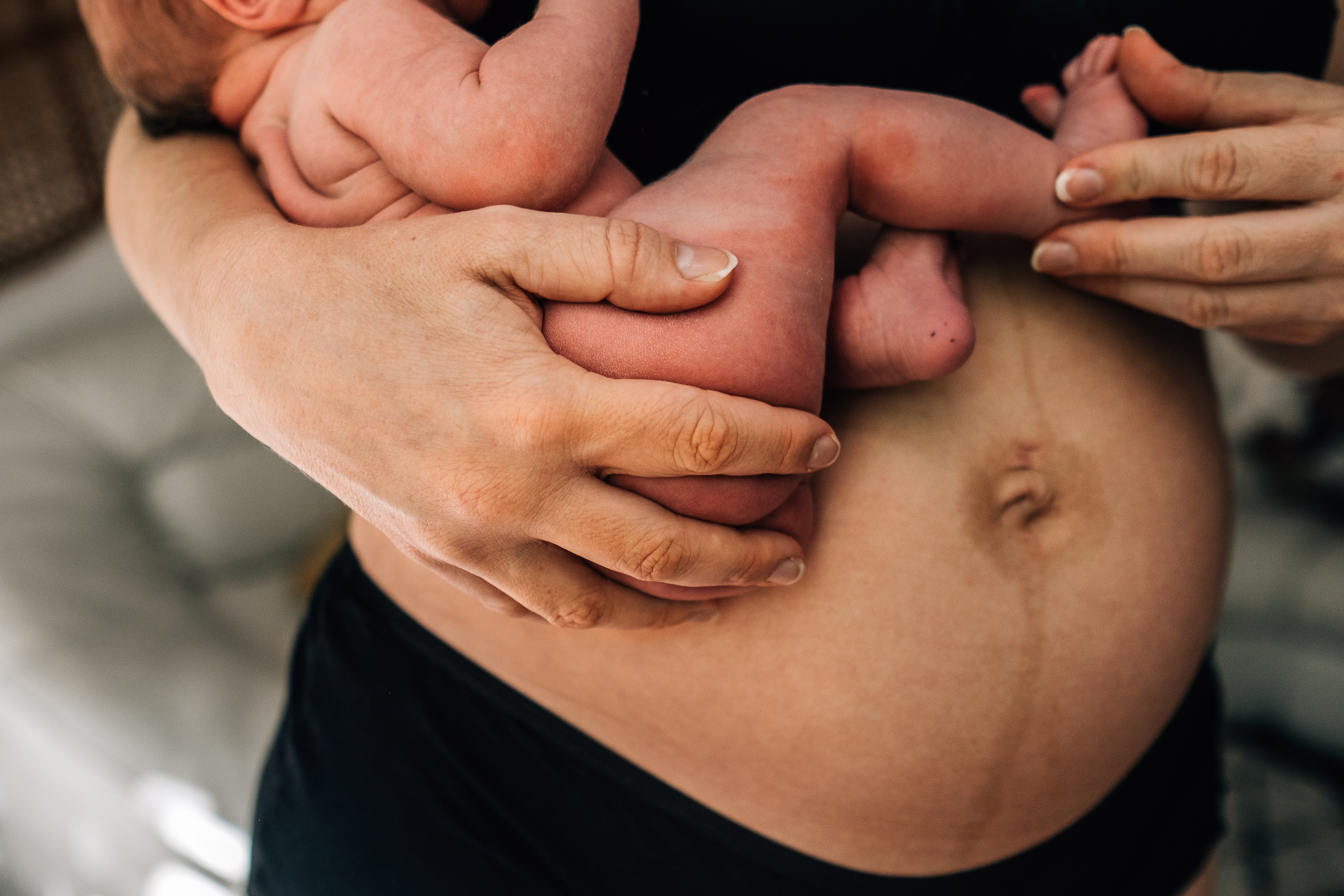 A picture of a post-partum stomach and the mother is holding her baby against her stomach