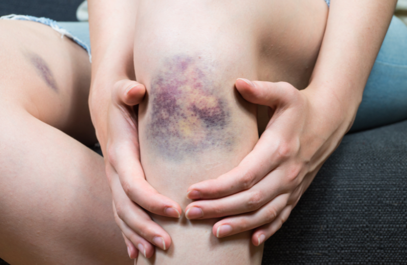 When to Avoid Tapotement Massage
