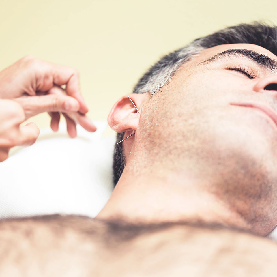 A man receiving auricular therapy, as a therapist applies acupuncture needles to his ear.