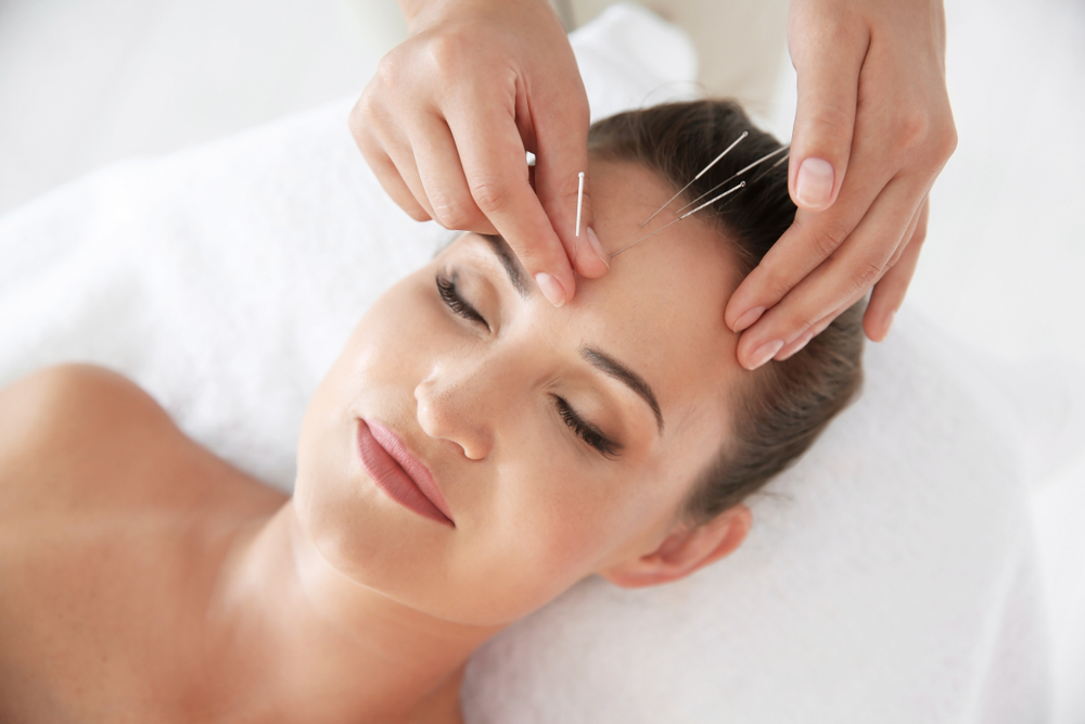 Acupuncture being carried out on the head.